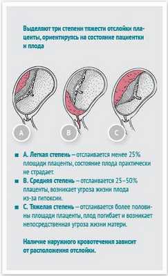 матка кувелера фото