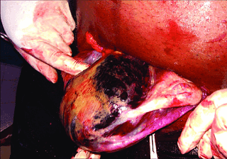 Матка Кувелера