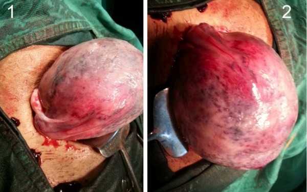 Матка Кувелера