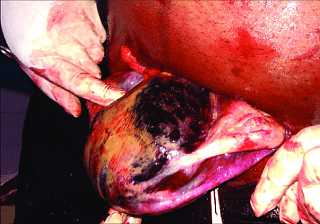 Матка Кувелера