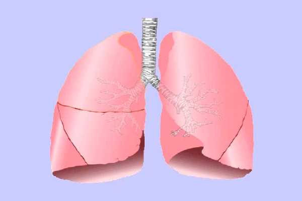 Пневмофиброз - особенности