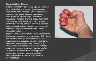 синдром леша нихана