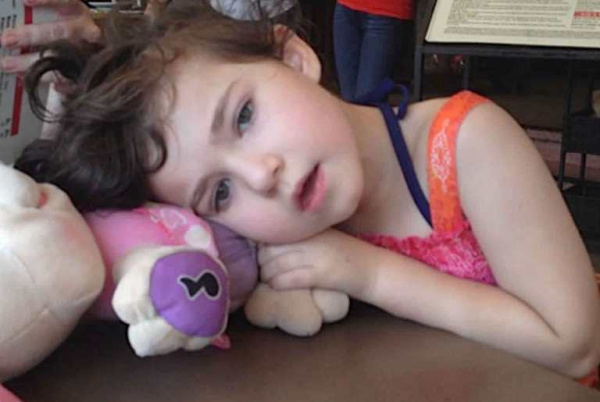 Синдром Айкарди