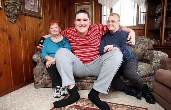 гигантизм причины