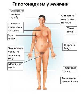 гипогонадизм у мужчин