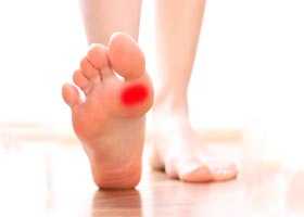 Неврома Мортона