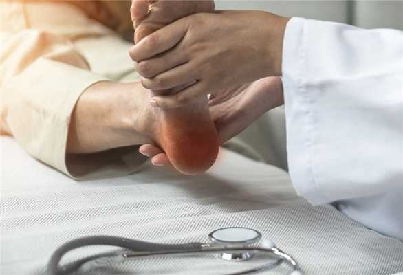 Принципы терапии дисплазии соединительной ткани