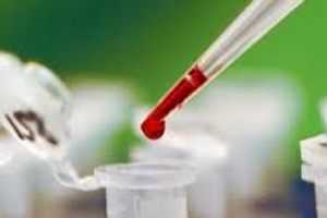 анализ на маркеры печени