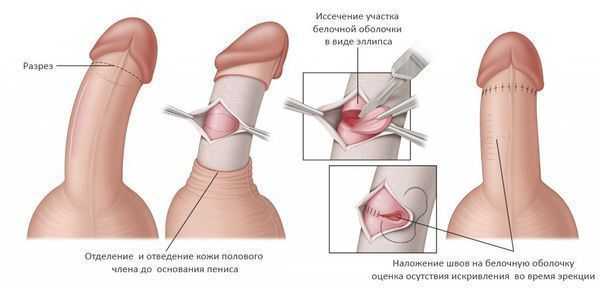 Операция Несбита