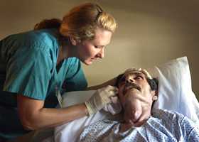 Синдром Гийена-Барре (острый полирадикулит)