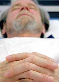 Синдром Гийена-Барре (острый полирадикулит)