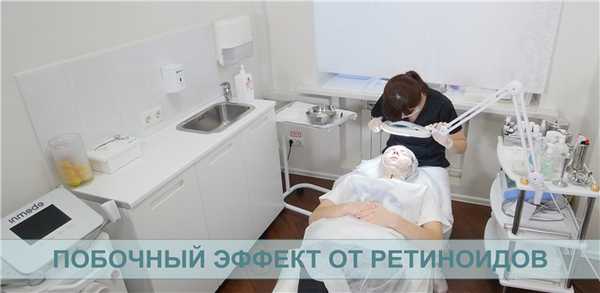 Побочный эффект от ретиноидов