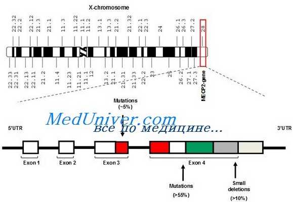 синдром Ретта