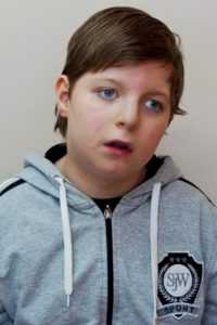 синдром Рубинштейна - Тейби