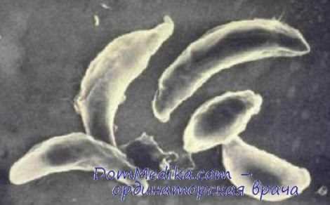 токсоплазмоз