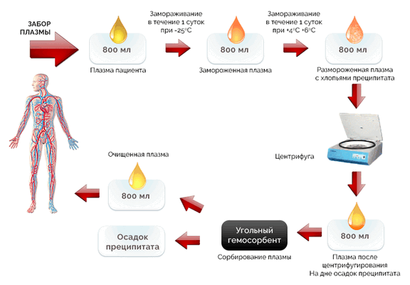 Криоаферез
