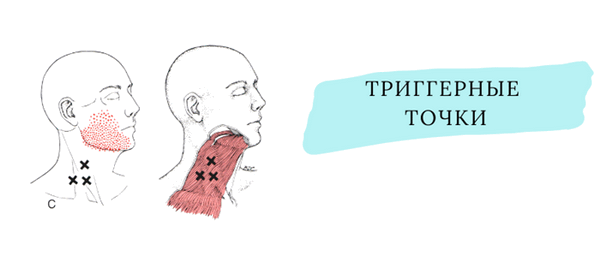 Триггерные точки шейного отдела