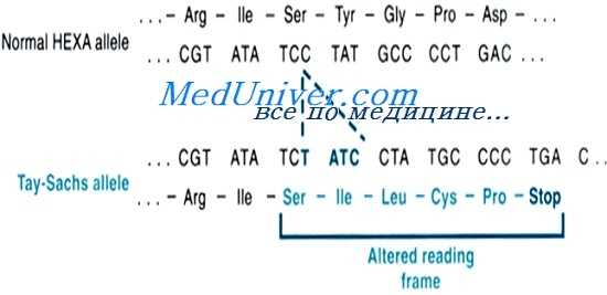 болезнь Тея-Сакса