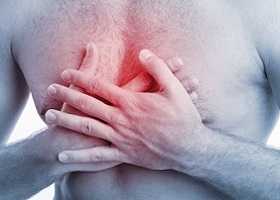 Синдром Титце