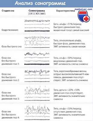 Анализ сонограммы