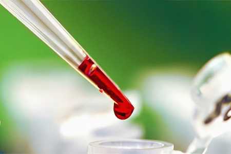 Норма D-димера