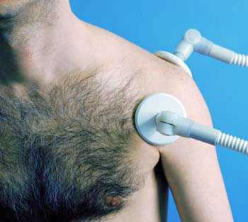 Снятие отёка, воспаления, боли в руке и плече, восстановление объёма движений в плечевом суставе и мышцах при лечении артроза (плечелопаточного периартроза, адгезивного капсулита) ускоряется при использовании физиотерапии.