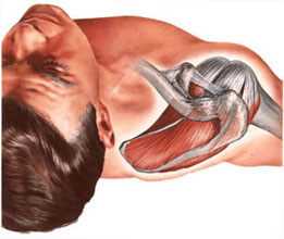 Мышцы плечевого сустава при диагностике артроза плечевого сустава (плечелопаточном периартрозе, адгезивном капсулите) спастически сокращены.