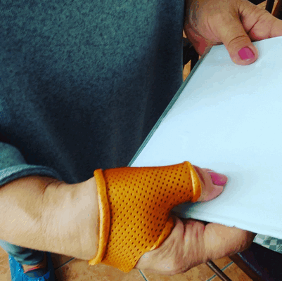 Артроз первого пястно-запястного сустава