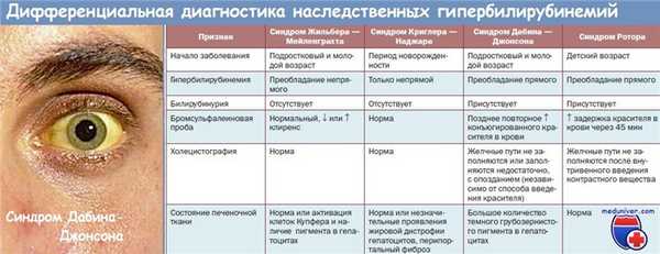 синдром Дабина-Джонсона и дифференциация гипербилирубинемий