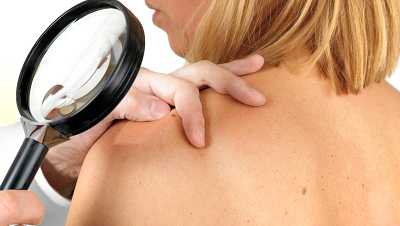 Осмотр кожи