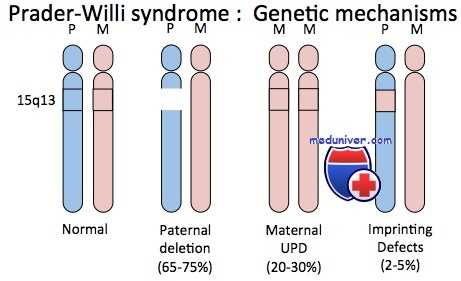 синдромы Прадера-Вилли