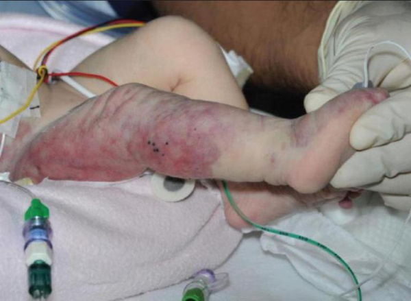 Характерные изменения ногтей при болезнях