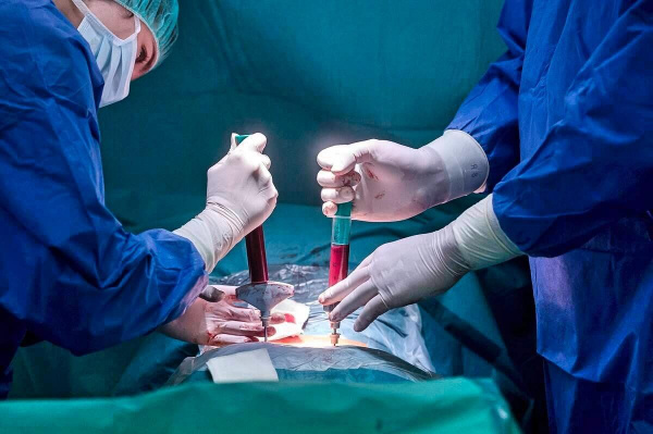 Хронический лимфолейкоз