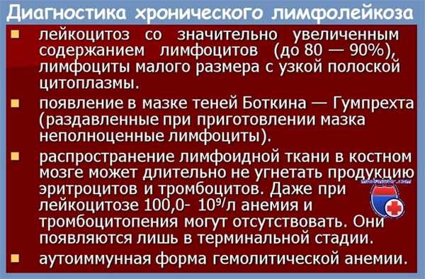 Диагностика хронического лимфолейкоза