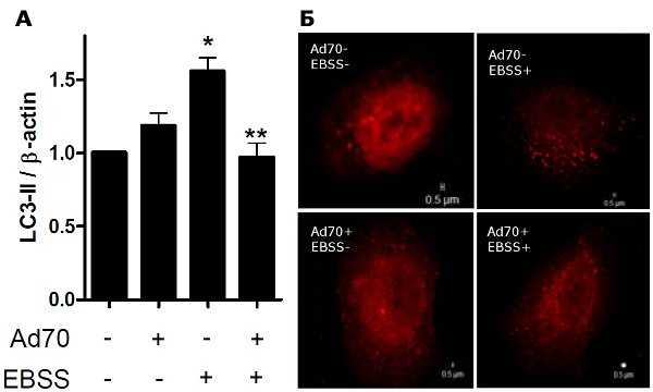 Рис. 1. HSP70 подавляет развитие аутофагии.