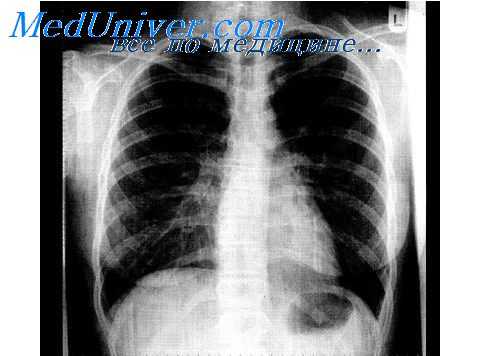 пролиферативные процессы при воспалении