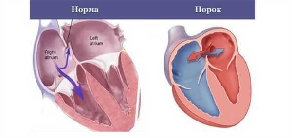 Перегородка