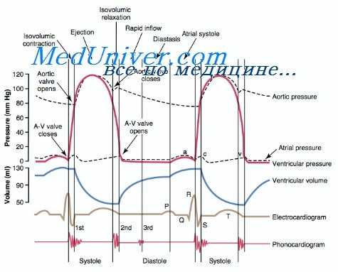 систолический шум при дмпп