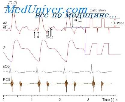 пансистолический шум