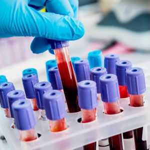 Анализ крови на антитела