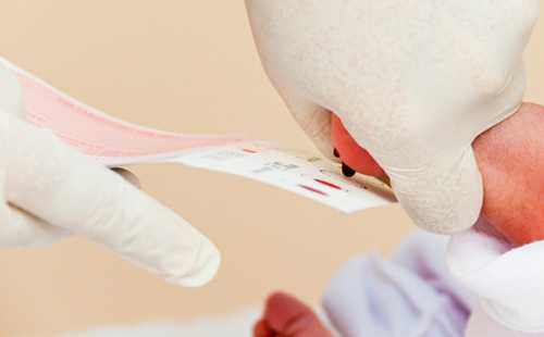 Скрининг новорожденных