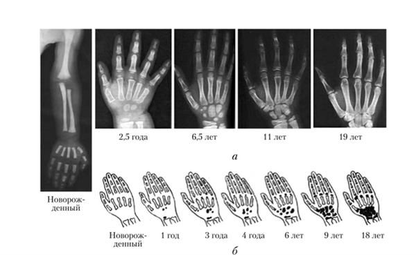 Развитие скелета кисти и стоны