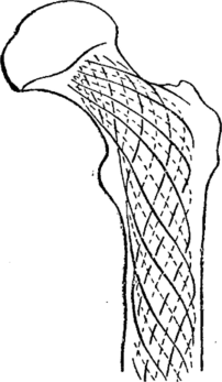 Упрощенная схема фронтального распила верхнего конца бедренной кости