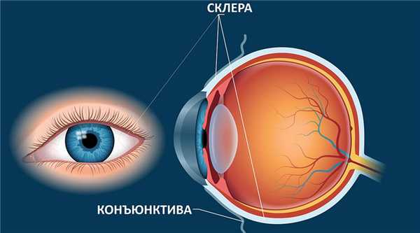 Склерокератит — заболевание, представляющее собой воспаление роговицы глаза и склеры