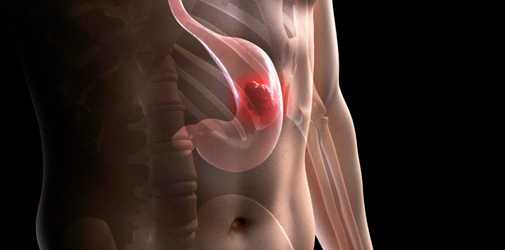 Стресс-гастрит и Алкогольный - Алкоклиник