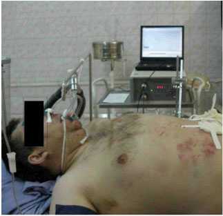 Рис.3. Аппарат для измерения микроциркуляции ЛАКК-02 (Лазма, Россия)