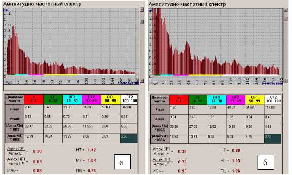 Рис. 6. Показатели АЧС Показатели микроциркуляции ишемизированной тонкой кишки (а) и после восстановления кровообращения после устранения (б) острой спаечной тонко-кишечной непроходимости