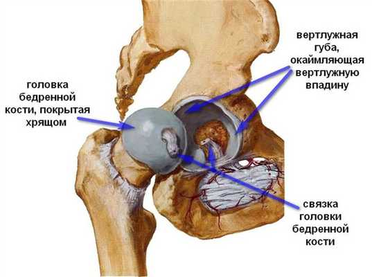 Деформирующий артроз тазобедренного сустава, лечение и профилактика