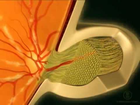 Видео Сетчатка