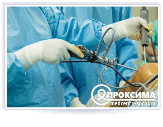 Методика удаления кисты Бейкера